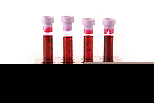 blood_tests_4